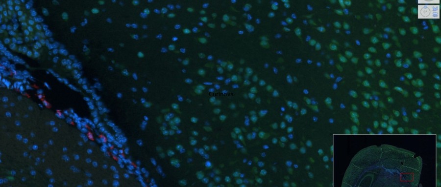 20x Fluorescent Whole slide scan service 100 slides